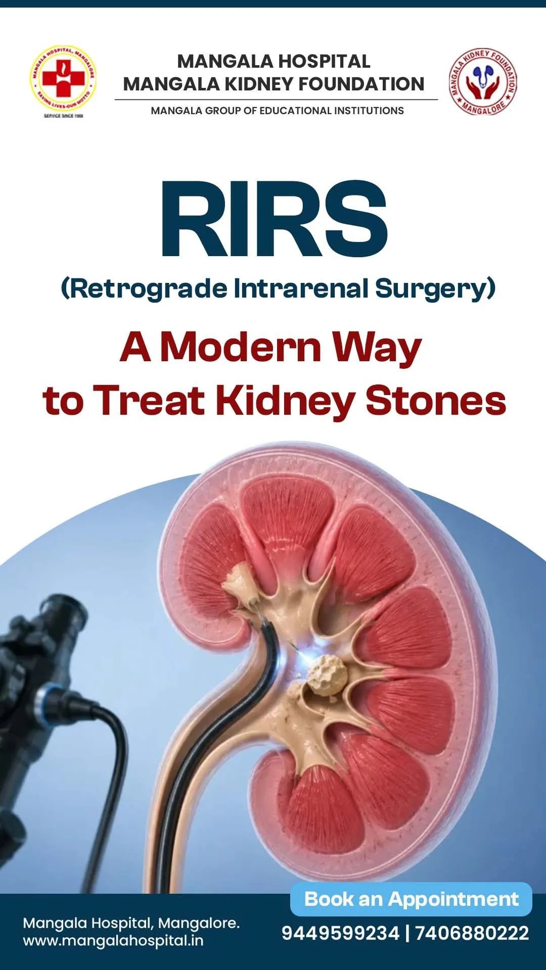RIRS laser treatment for kidney stones